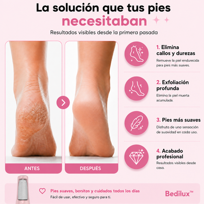 Bedilux™ Oficial | Eliminador de callos eléctrico